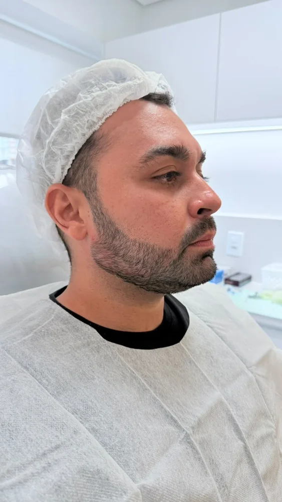 Depois do tratamento